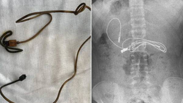  இத்தகைய அறிகுறிகள் இருந்தால் 