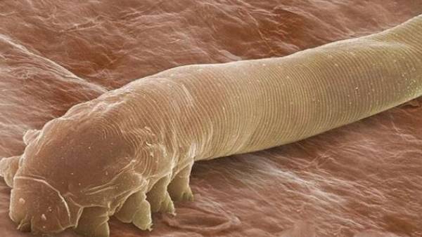 முகத்தில் வாழும் பூச்சிகள் முகத்தில் வாழும் பூச்சிகள்