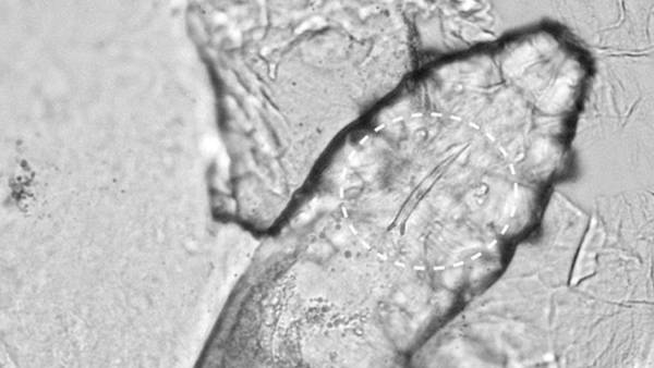 நுண்ணுயிரிகளின் உலகம் நுண்ணுயிரிகளின் உலகம்