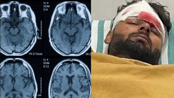 மூளையின் செயல்பாடுகள் 