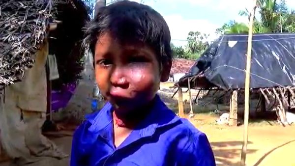 சிகிச்சை உள்ளது; பணம் இல்லை சிகிச்சை உள்ளது; பணம் இல்லை