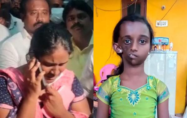 அரியவகை நோயால் பாதிக்கப்பட்ட சிறுமி 