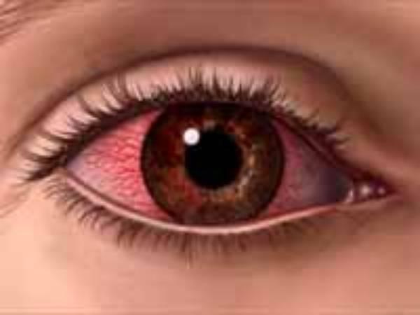 தனிமைப்படுத்தி கொள்ளவும் 