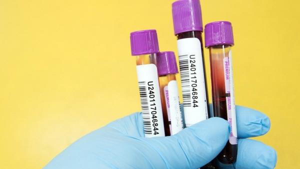  ரத்த பிரிவுகள்