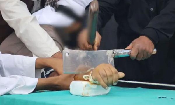  கைகள் துண்டிப்பு