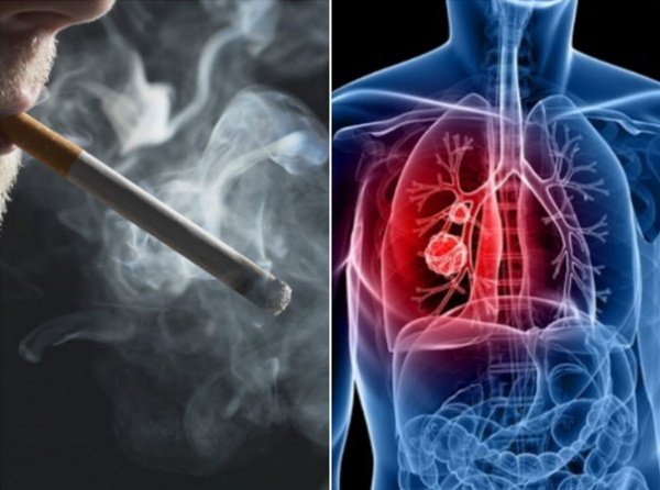 மோசமான பாதிப்பு