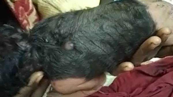 உடல் முழுக்க அடர் முடி உடல் முழுக்க அடர் முடி