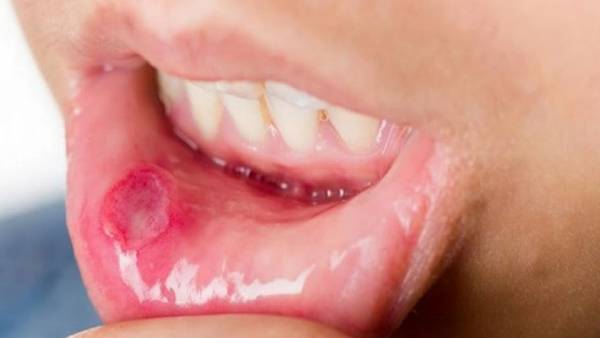  என்ன பிரச்சினை வரும்