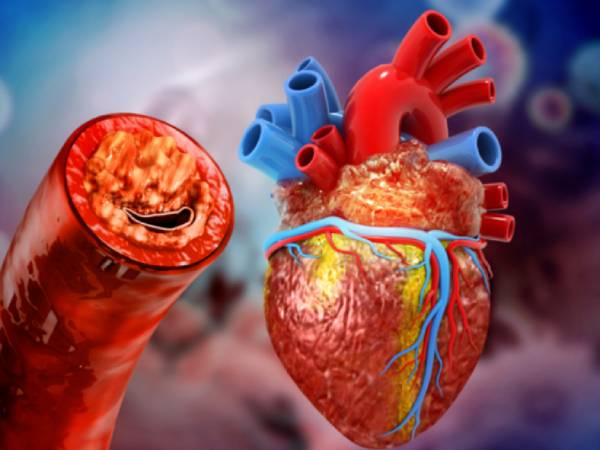 இதய நோய் 