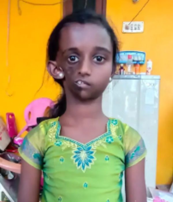 இரண்டாம் கட்ட சிகிச்சை இரண்டாம் கட்ட சிகிச்சை