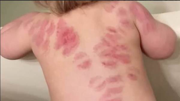 தீவிர விசாரணை தீவிர விசாரணை