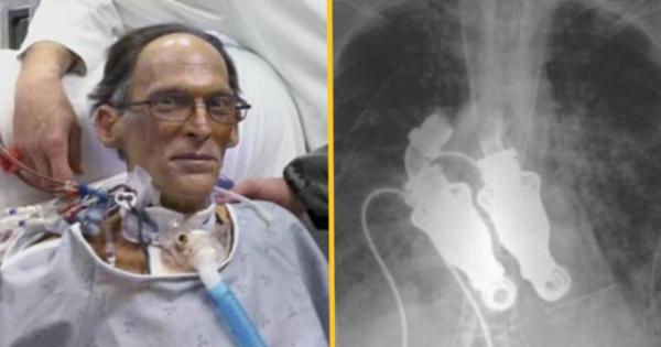  இதய பாதிப்பு