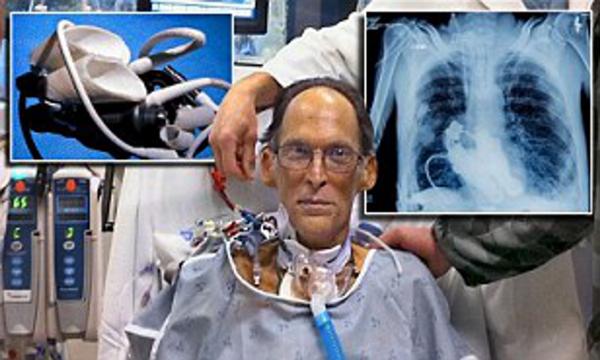  என்ன செய்யும்