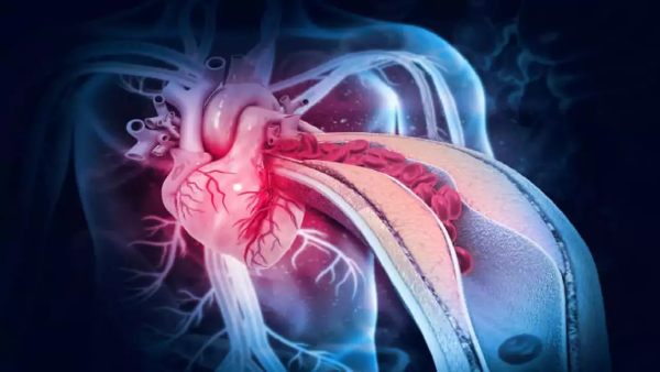 அரிதான காரணங்கள் 