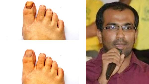 செருப்பு கூட அணியாதவர்கள் 
