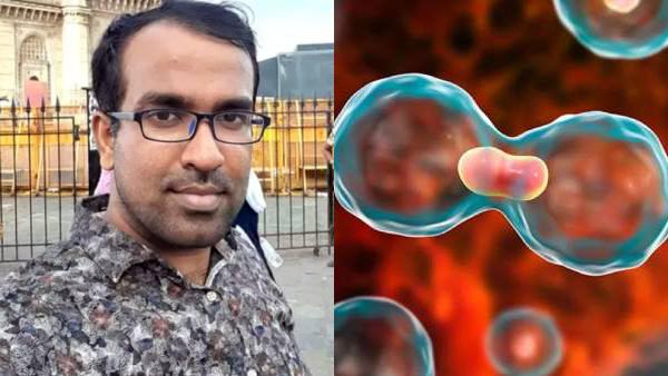 7. கல்லீரல் புற்று நோய் (LIVER CANCER ) 