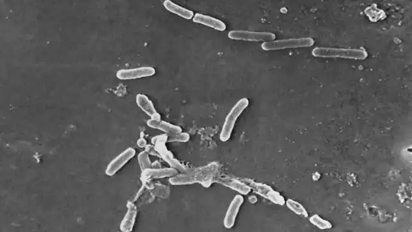 மாதிரிகள் சேகரிப்பு