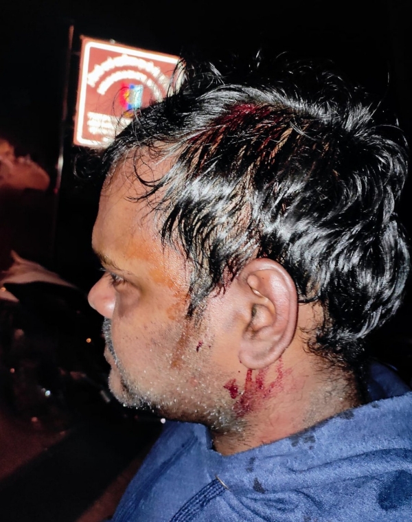 தமிழ் மாணவர்கள் காயம் 