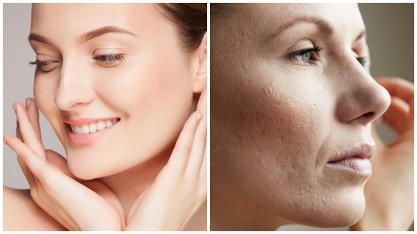 கருவளையம் 