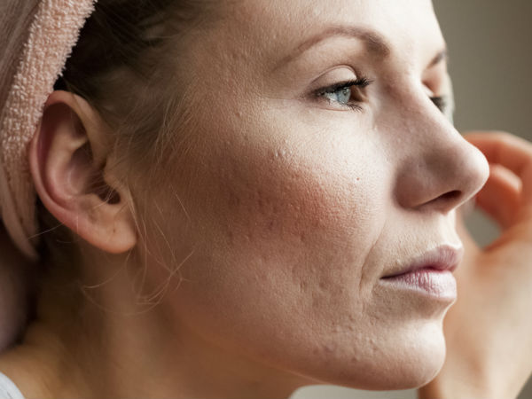  எச்சரிக்கை தேவை