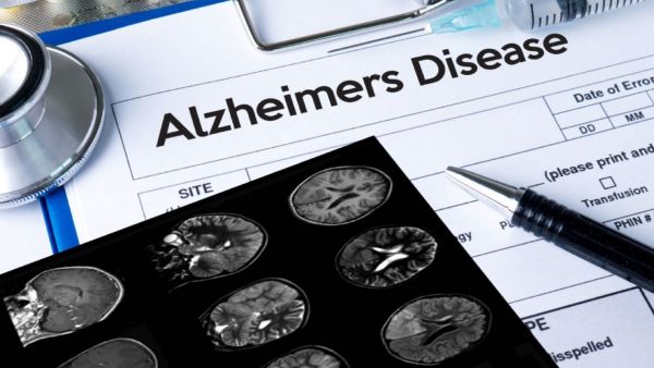  குறுகிய கால நினைவாற்றல் இழப்பு 