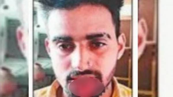  கொட்டிய ரத்தம்