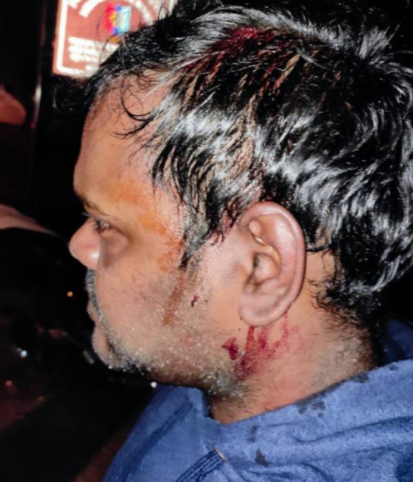  ஏபிவிபி தாக்குதல்