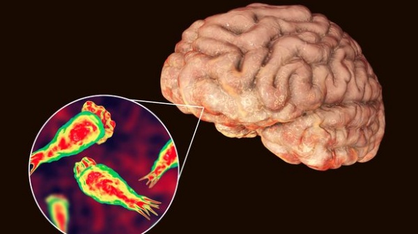 மூளையை தின்னும் அமீபா