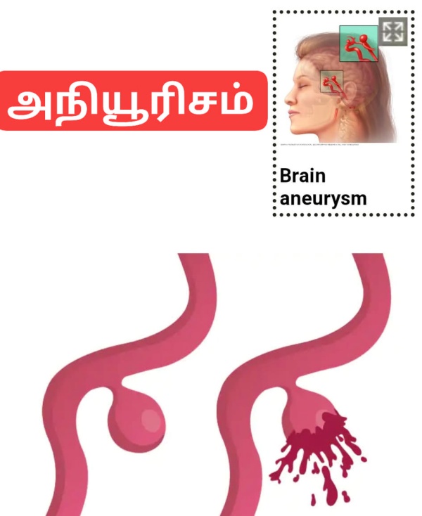 சிகிச்சை என்ன