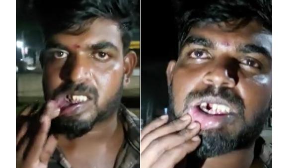 அந்தரங்க உறுப்பை நசுக்கி 