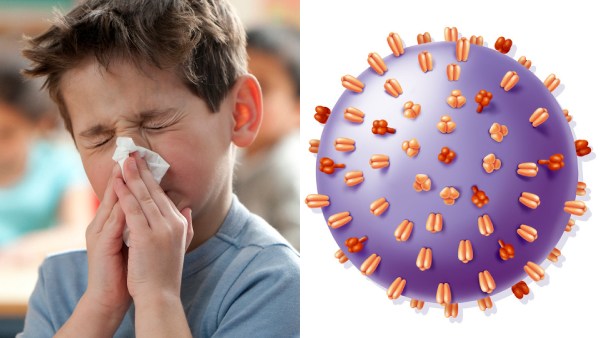 A H3N2 வைரஸ் பாதிப்பு