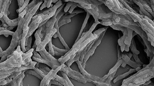  ரொம்ப குறைவு