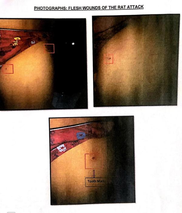  சிக்கலில் சிக்கிய ஓட்டல்