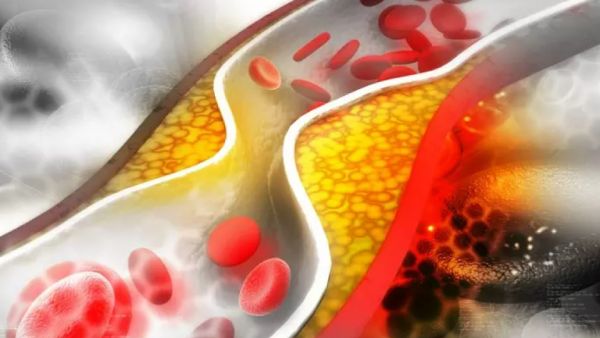 கொழுப்பு கொழுப்பு