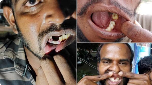 துவங்கிய விசாரணை 