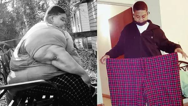  300 கிலோ உடல் எடை 