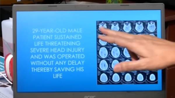  Using 3D technology, govt. hospital doctors in Chennai restore contour of skull in 29-year-old man