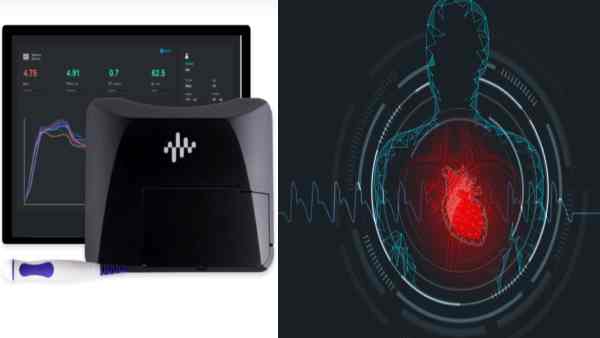 Madras IIT Researchers have found ARTSENS Plus, this divice very good for checking blood pressure Madras IIT Researchers have found ARTSENS Plus, this divice very good for checking blood pressure