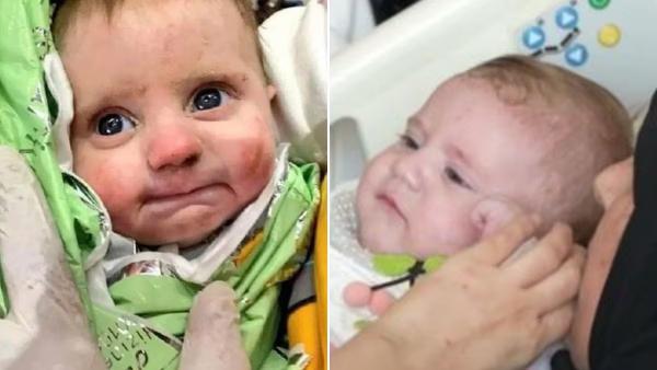  அதிசய குழந்தை