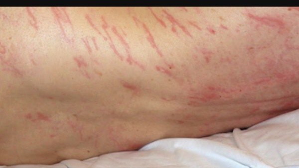 புழுக்கள் 