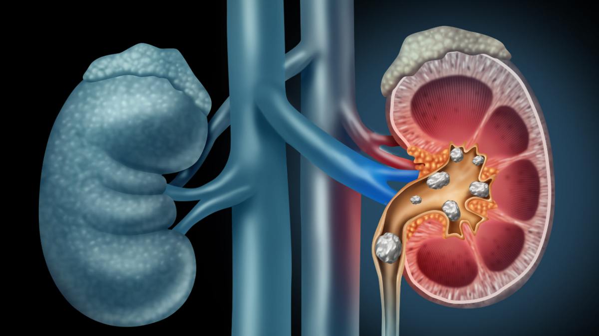 Does Intermittent Fasting Harm Fertility and whats Intermittent fasting 