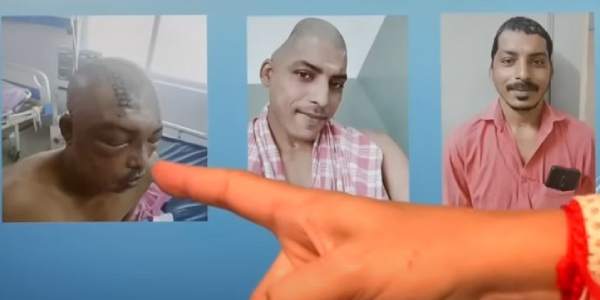  Using 3D technology, govt. hospital doctors in Chennai restore contour of skull in 29-year-old man