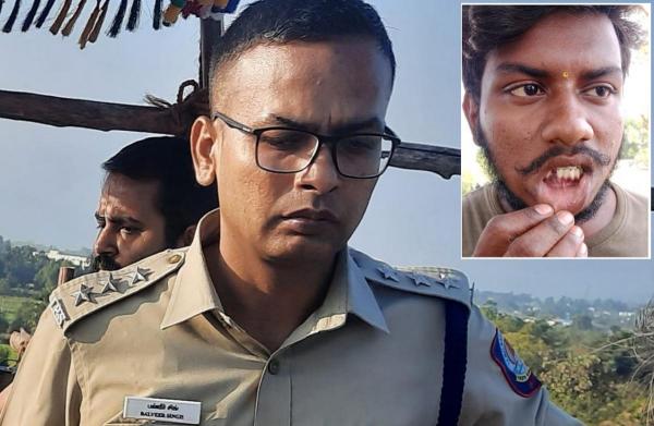  பல்பிடுங்கி விவகாரம்