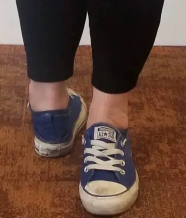 32 years old woman rotates her feet back to front with 171 degrees 32 years old woman rotates her feet back to front with 171 degrees