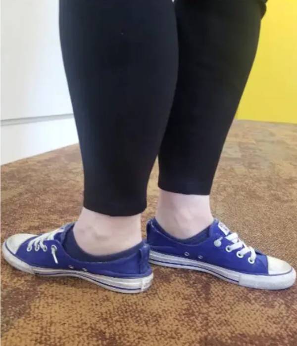 32 years old woman rotates her feet back to front with 171 degrees 32 years old woman rotates her feet back to front with 171 degrees