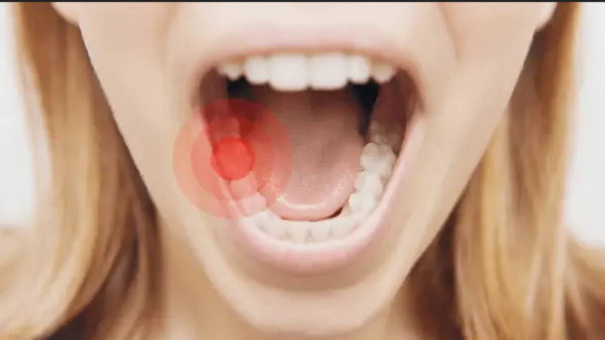 What Causes Toothache?...How to Prevent Tooth Decay?