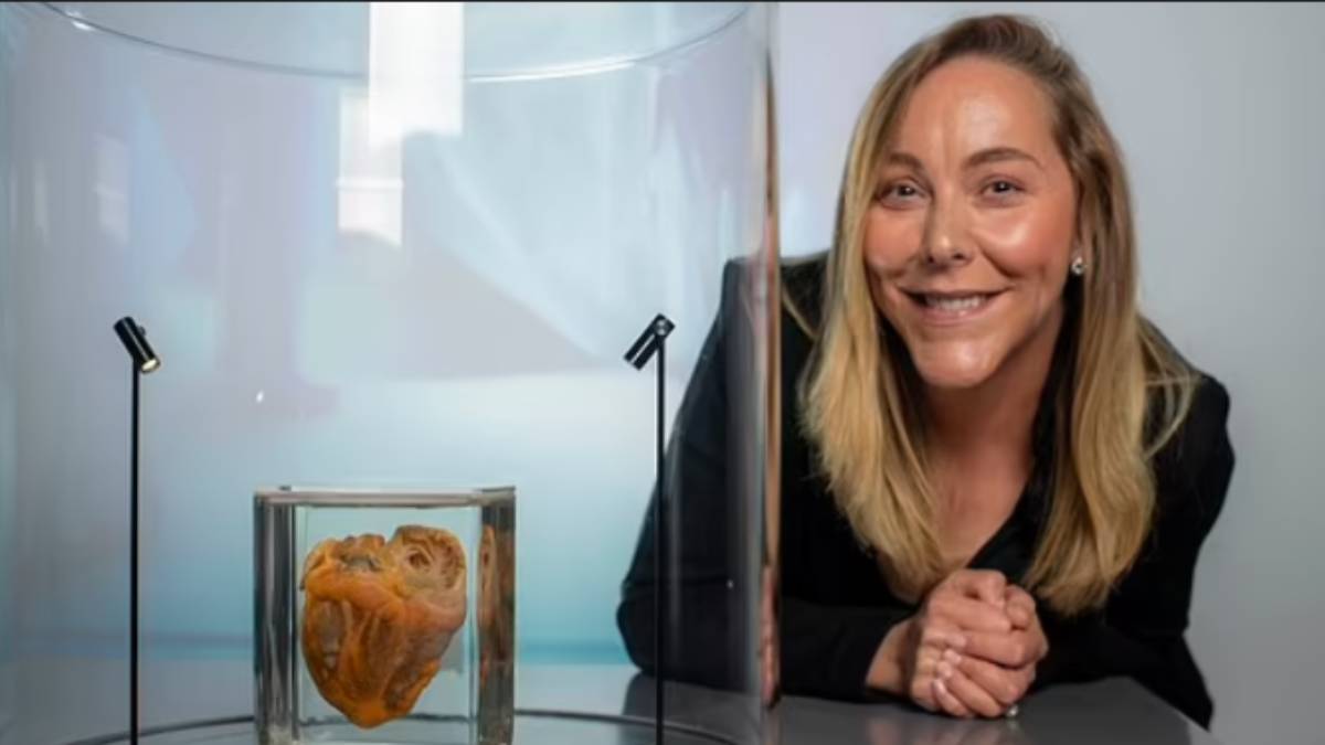 16 Years After Transplant Surgery, Woman Sees Her Own Heart On Display At Museum 16 Years After Transplant Surgery, Woman Sees Her Own Heart On Display At Museum