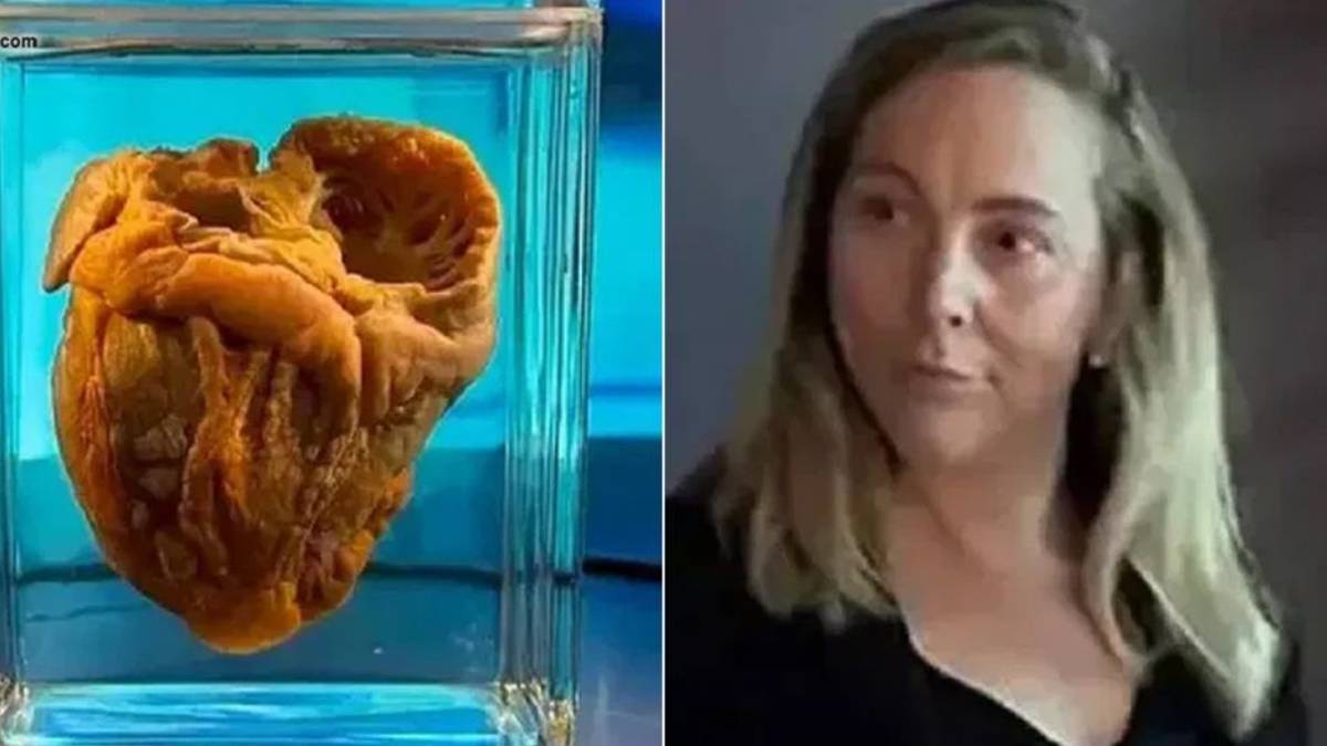 16 Years After Transplant Surgery, Woman Sees Her Own Heart On Display At Museum 16 Years After Transplant Surgery, Woman Sees Her Own Heart On Display At Museum