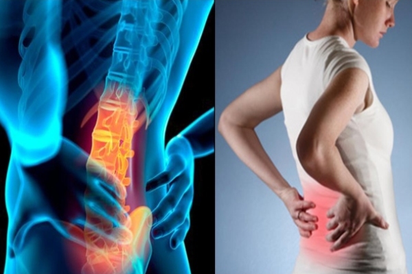 Why back pain occurs after Cesarean delivery..here is simple tips