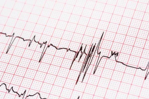 Doctors says that Senthil Balajis ECG report was abnormal 